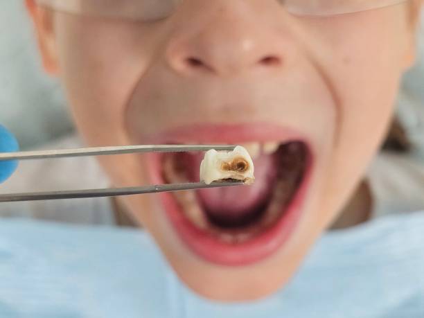 Best Emergency Dental Care for Abscessed Tooth in Dewey, OK