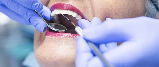 Best Emergency Dental Extractions in Dewey, OK